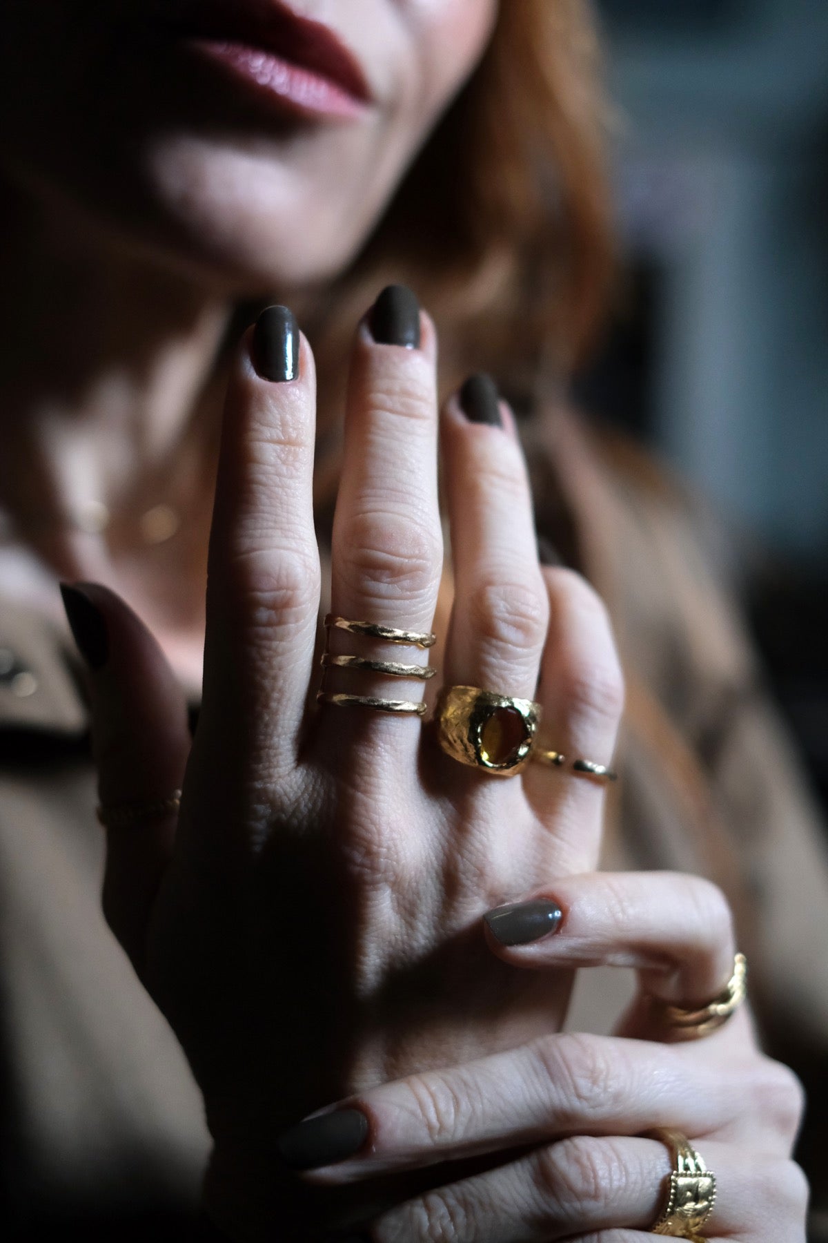 Anello Lati